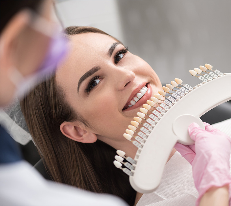 porcelain veneers in lively